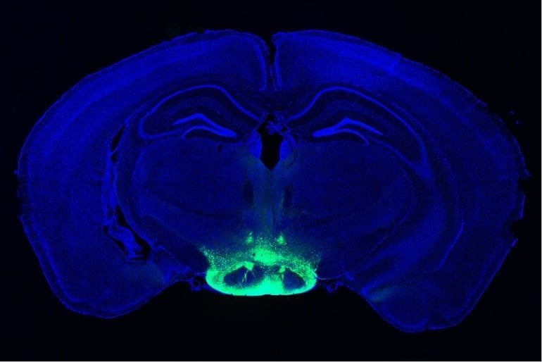 This shows a mouse brain slice