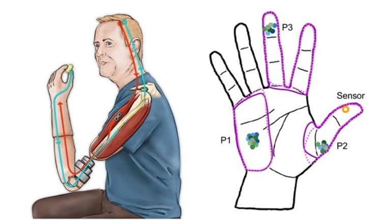 This shows a diagram of a hand and a man with a bionic arm