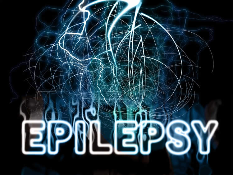 the word epilepsy is shown