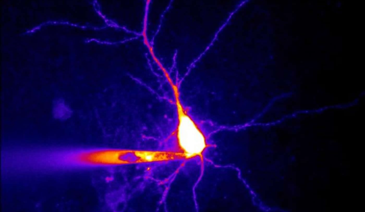 Image of a hippocampal neuron.