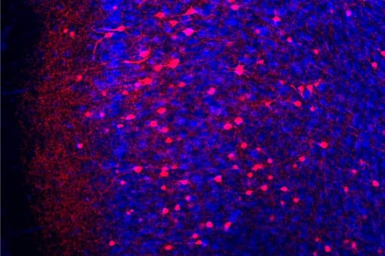 This shows neurons in the pfc