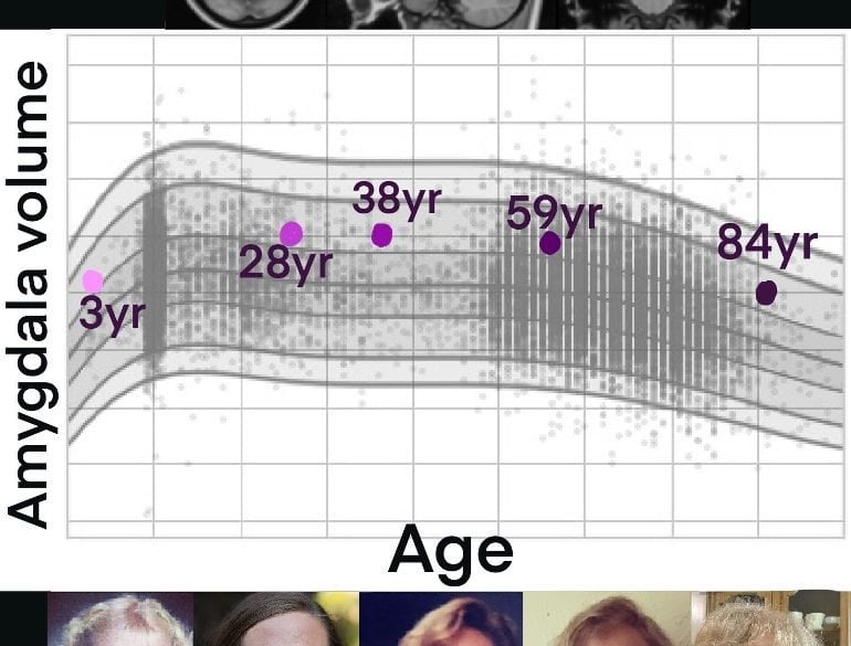 This shows a growth chart, brain scans, and the faces of females at different ages from childhood to old age