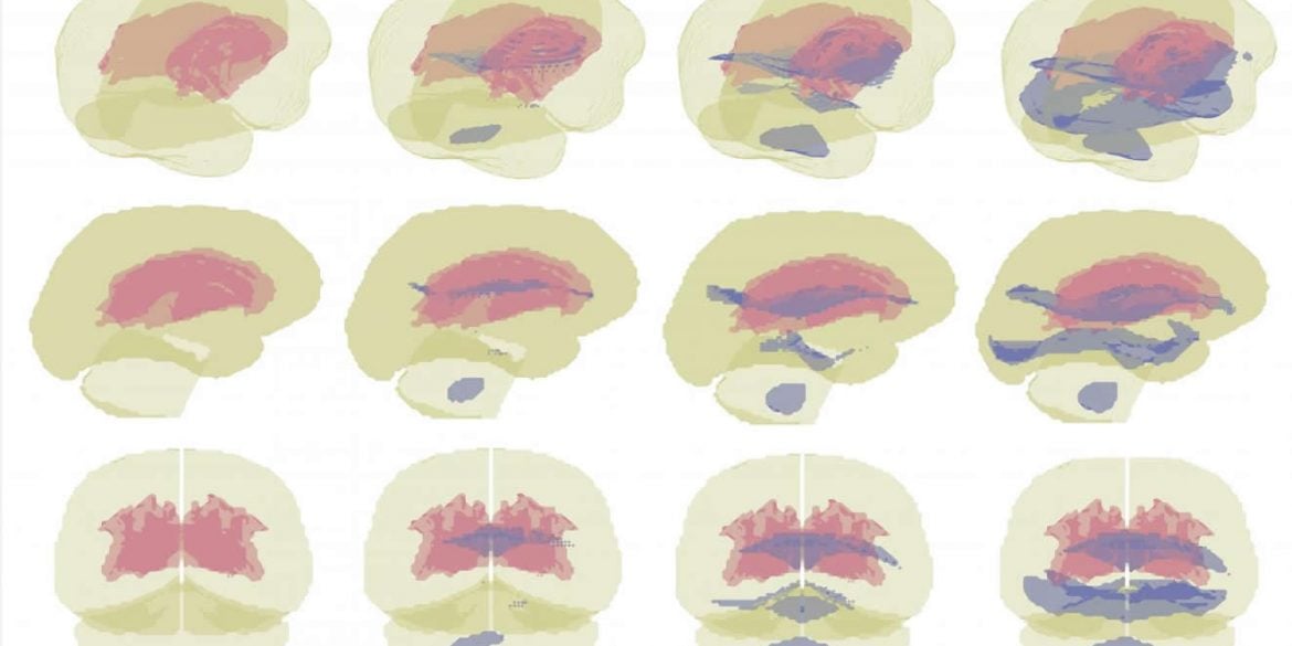 this shows brain scans