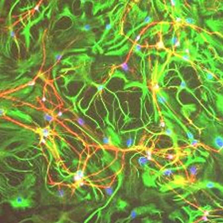 This image shows neurons from a mouse hippocampus.