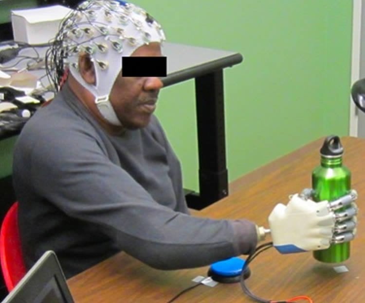 This shows a person using the technology to control a prosthetic hand.