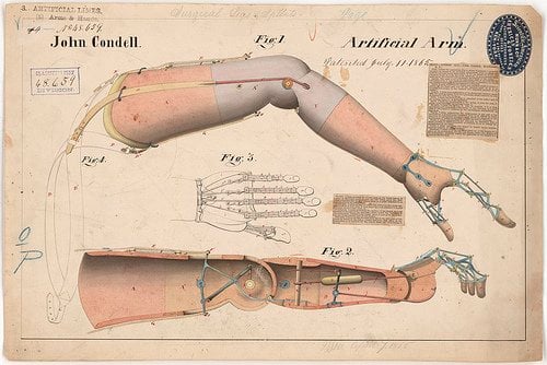 This is an old schematic of an artificial arm and hand.