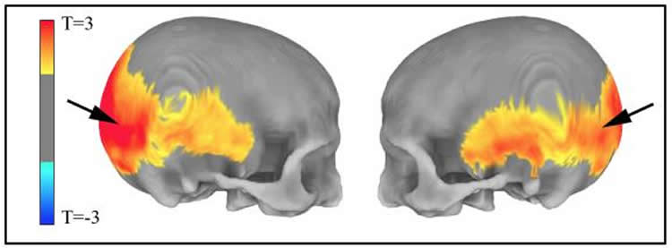 Image shows skull imaging.