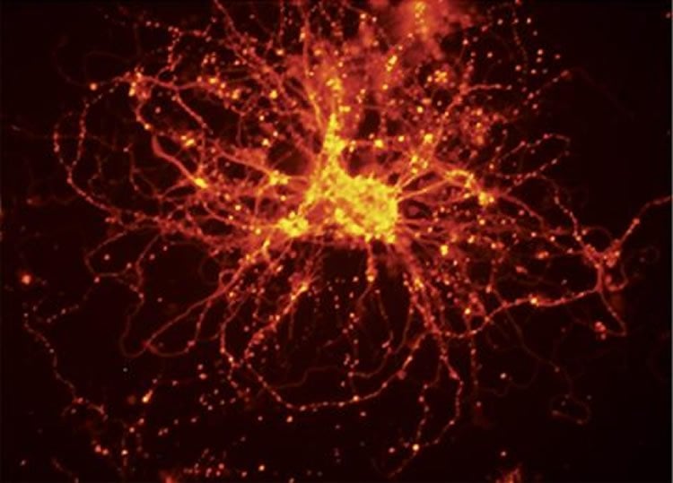 The image shows neurons created from the iPSCs.