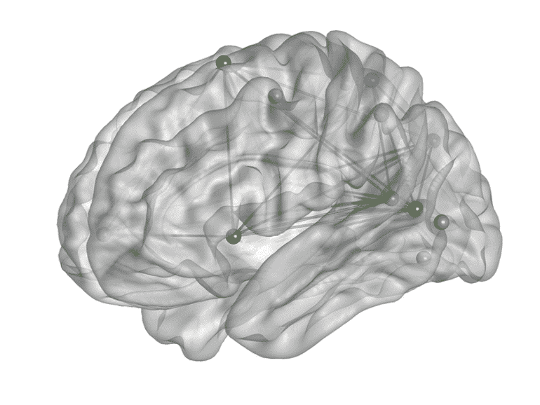 this shows the van-dan network in the brain